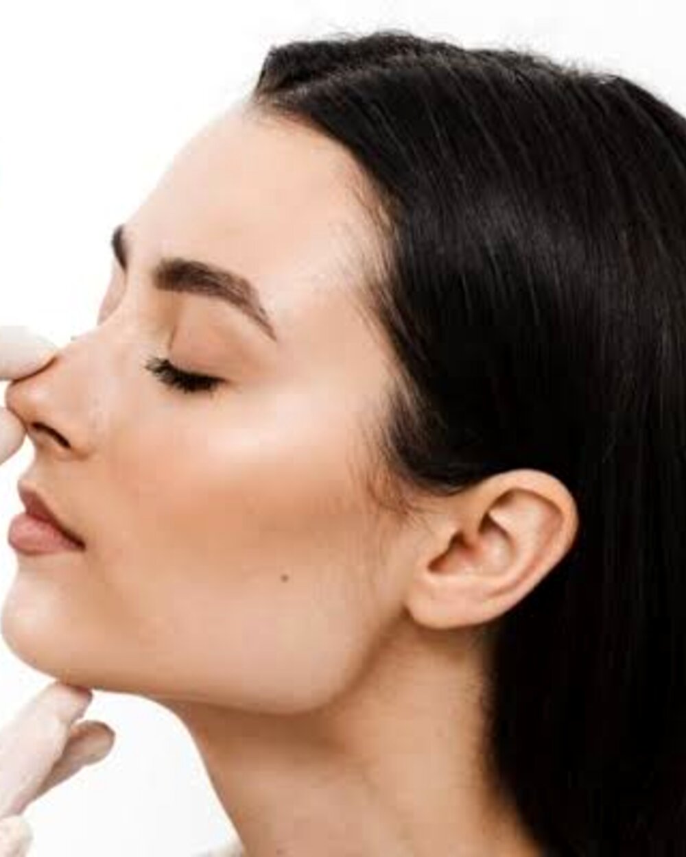 Rinoplastia